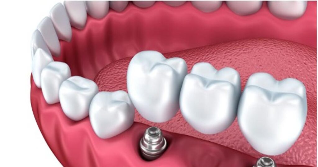 Dentista en Villadecavalls