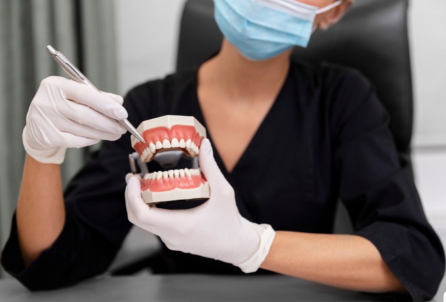 implantes dentales