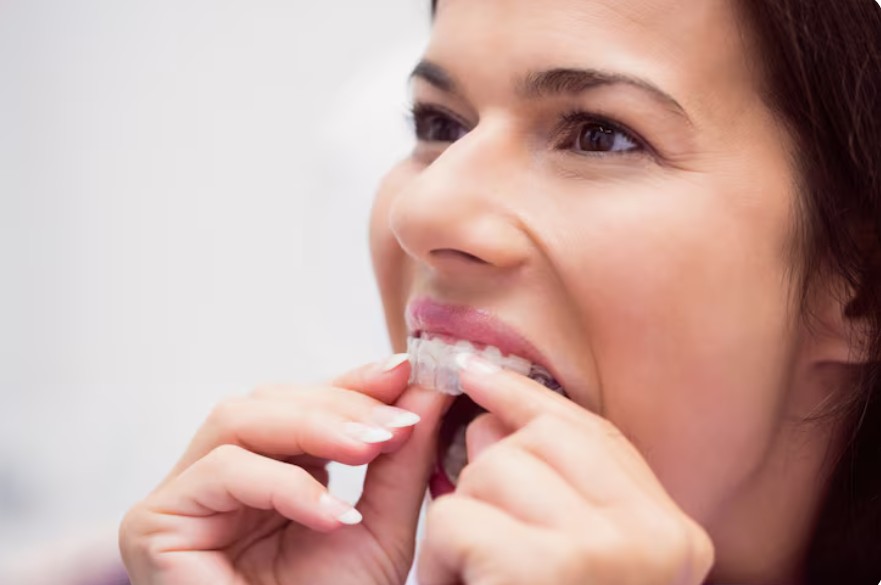 Invisalign Terrassa