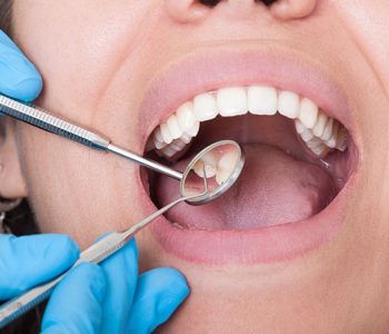 caries-dentales-clinica-lorenzo-zaragoza