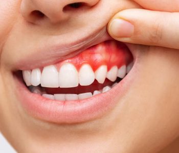 converted_periodoncia-2_compressed.jpg6_